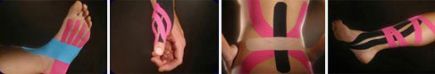 kinesio examples